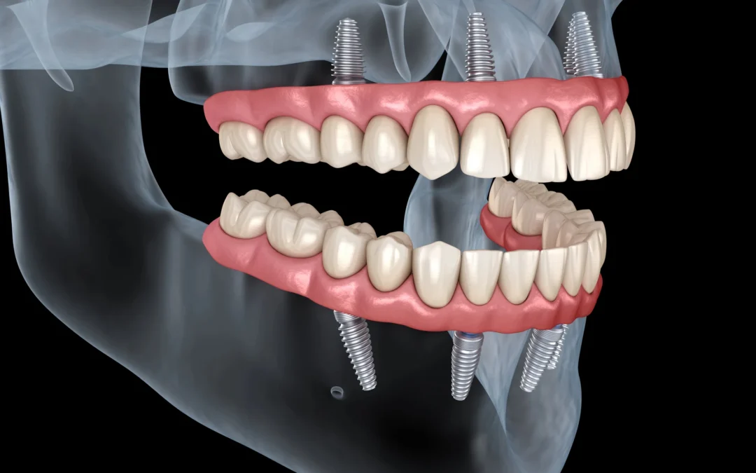 Can a Dentist Fix Uneven Gums? What to Know About Gum Recontouring