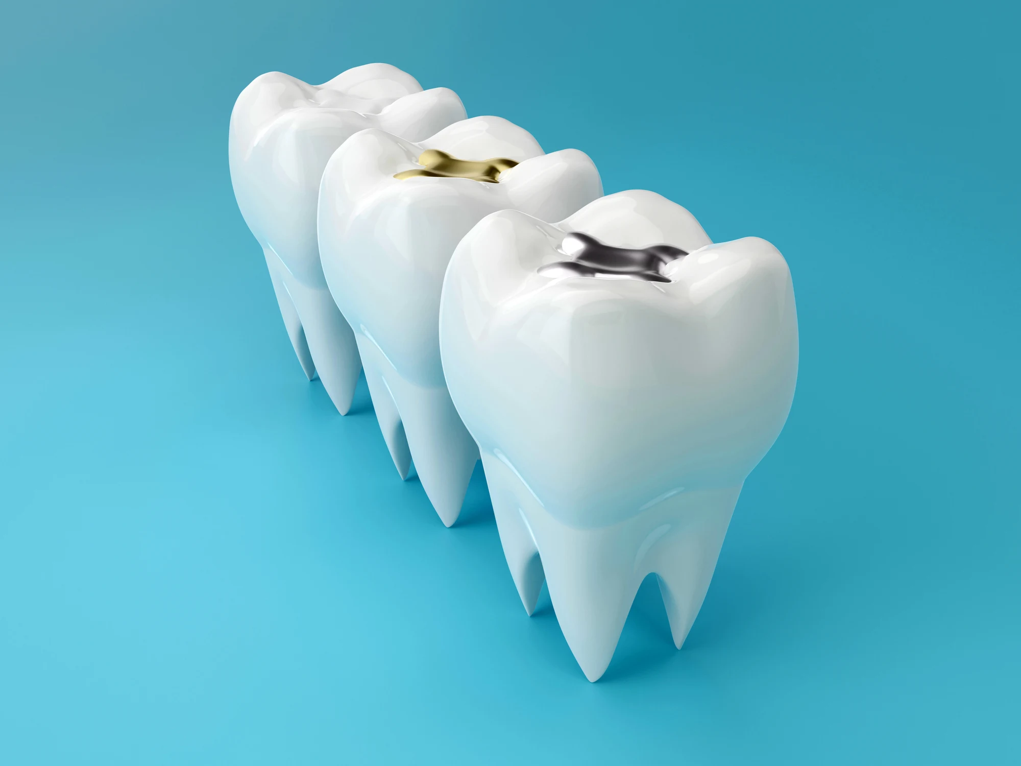Waxhaw Dentist Addresses The Need For Dental Sealants