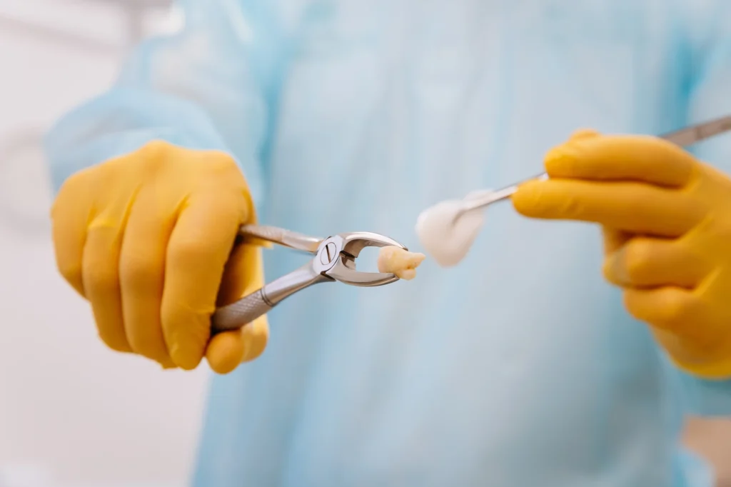 dentist holding tooth after tooth extraction in waxhaw