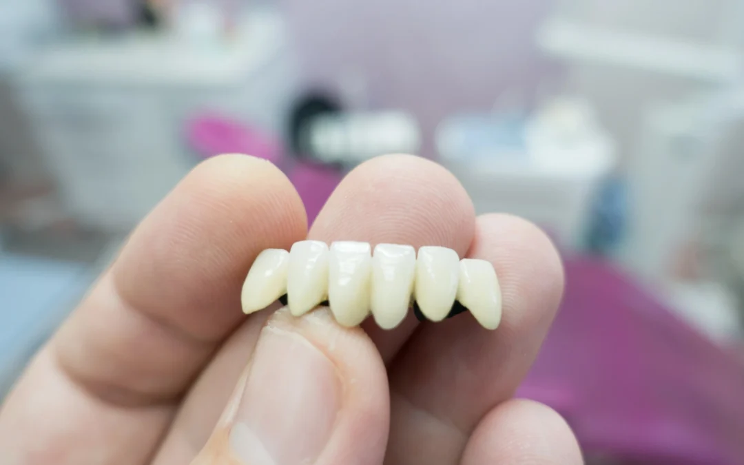 Dental Crowns for Long-Term Oral Health: What Patients Should Know
