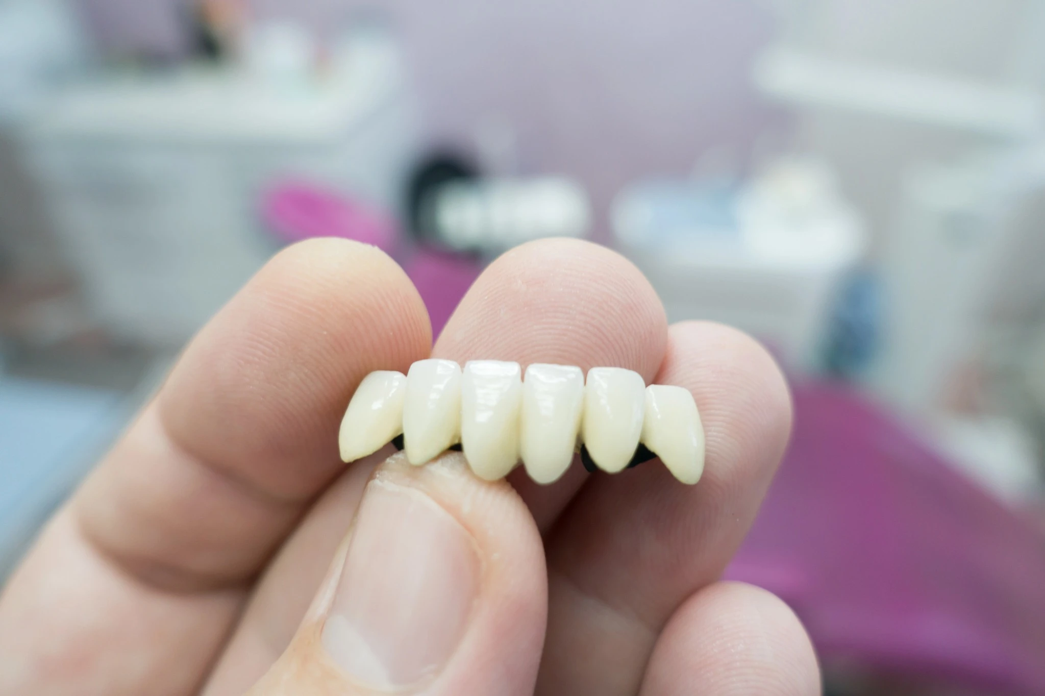 waxhaw-dental-crown-ceramic-bridge-closeup-lab