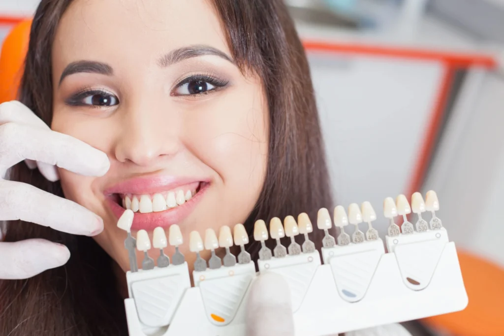 waxhaw-dental-crowns-shade-matching-smile-consultation