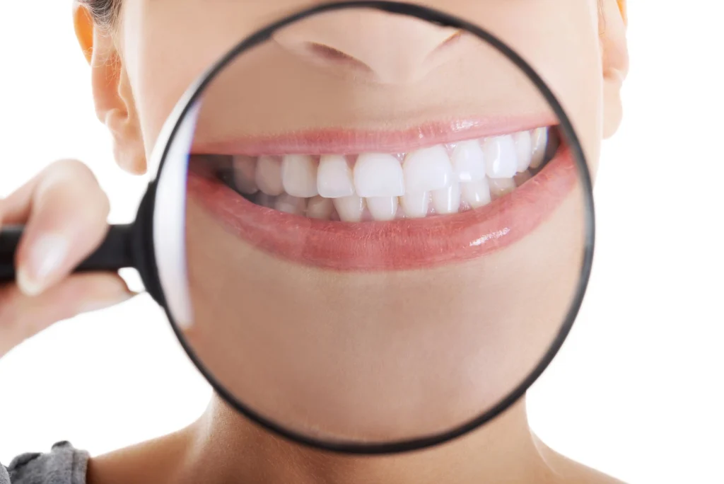 teeth-whitening-waxhaw-bright-white-smile