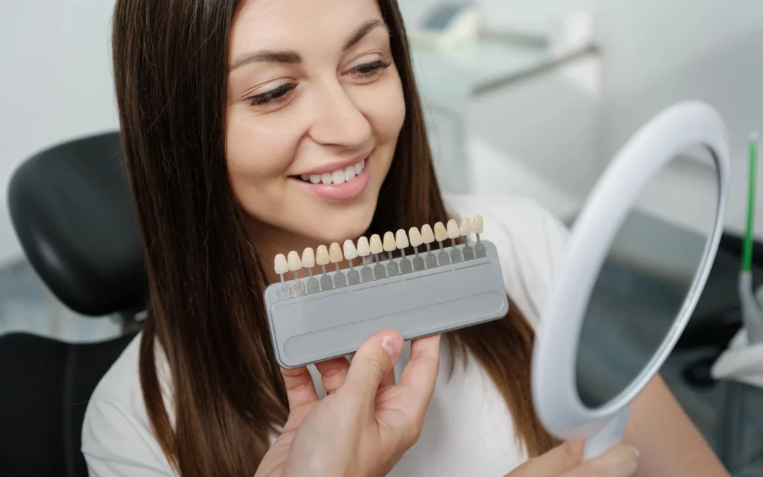 How Dentists Design Veneers to Match Your Smile 
